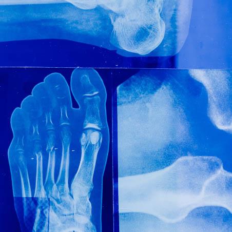 Service Foot and Ankle Surgery Image