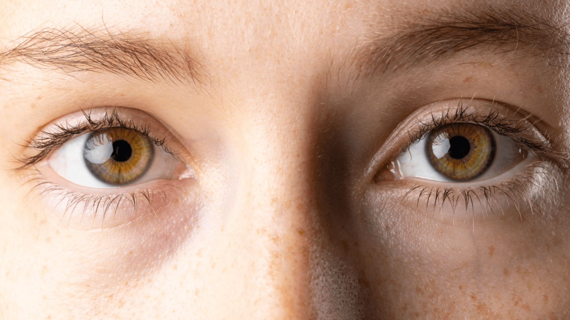Can Eye Color Really Reveal Disease?'s featured image