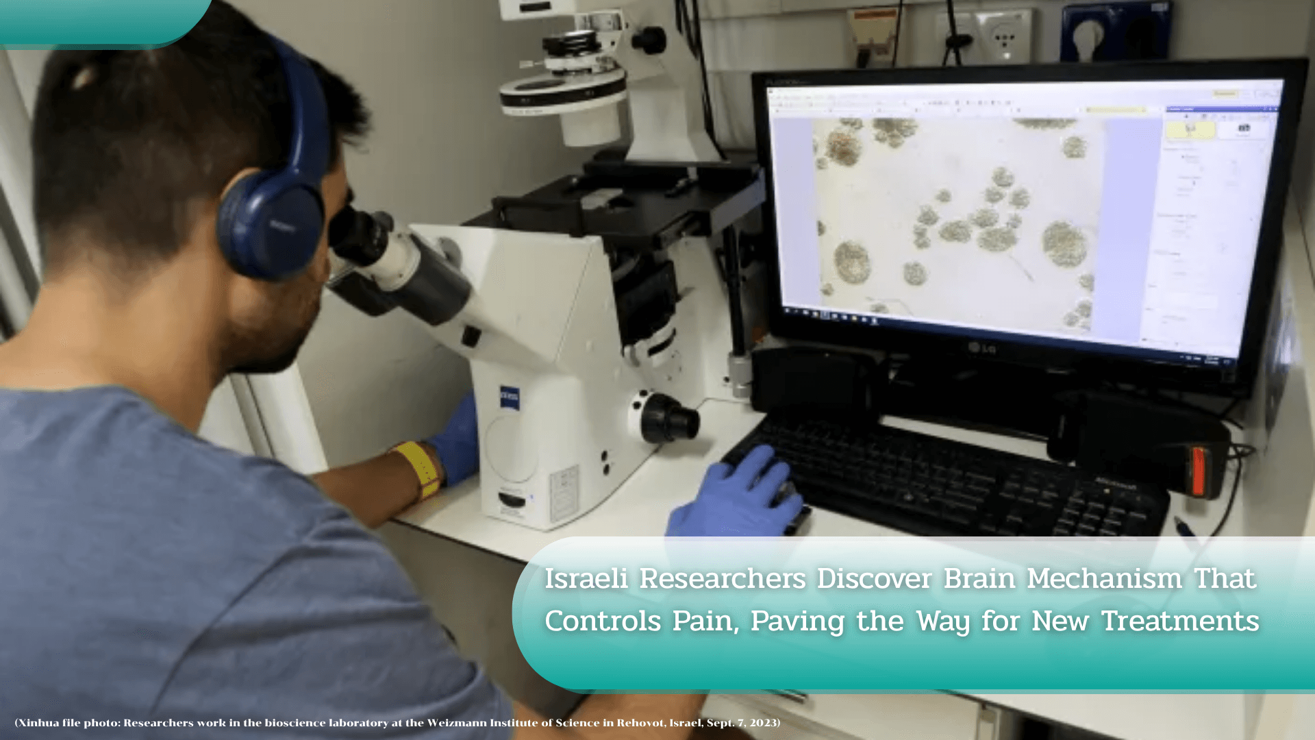 Israeli Researchers Discover Brain Mechanism That Controls Pain, Paving the Way for New Treatments's featured image